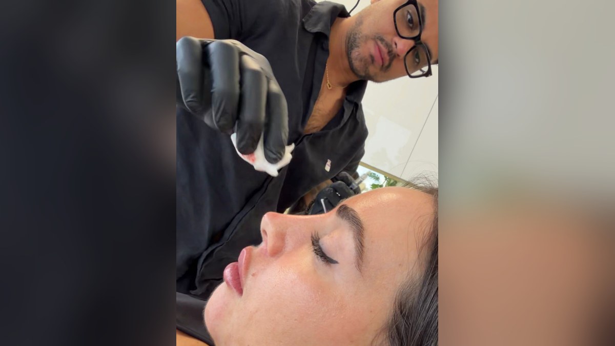 Non-Surgical Rhinoplasty in Miami | Yeny Liscano MedSpa